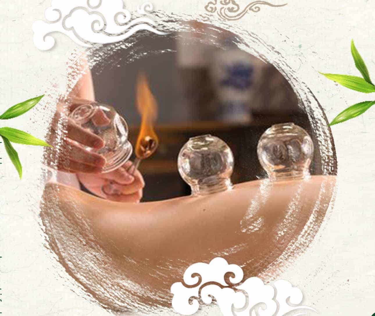 How To Effectively Do Cupping Therapy at Home