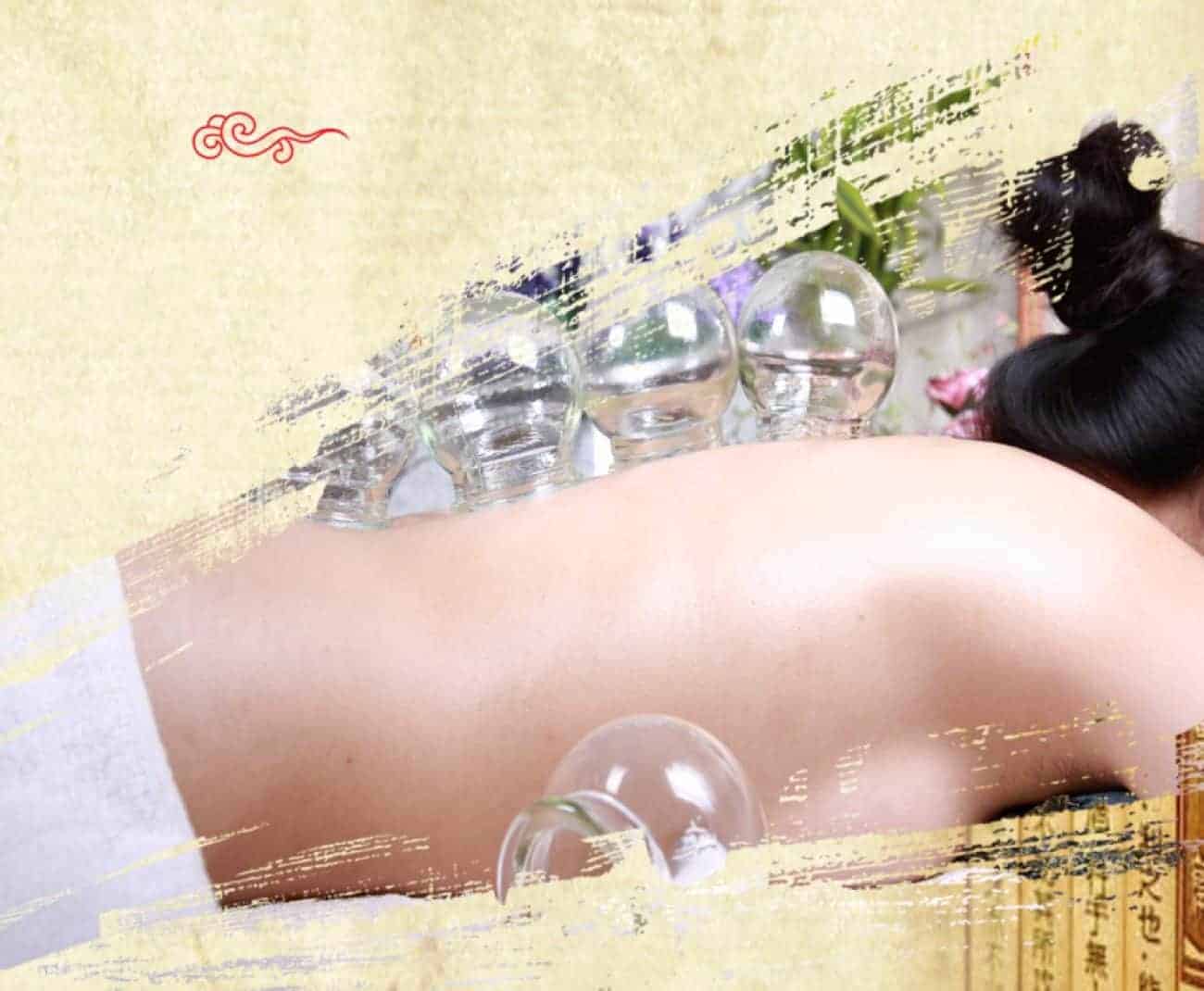 Top 10 Health Benefits of Cupping Therapy